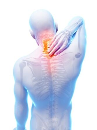 Spinal osteochondrosis, diin kinahanglan ang Hondrocream