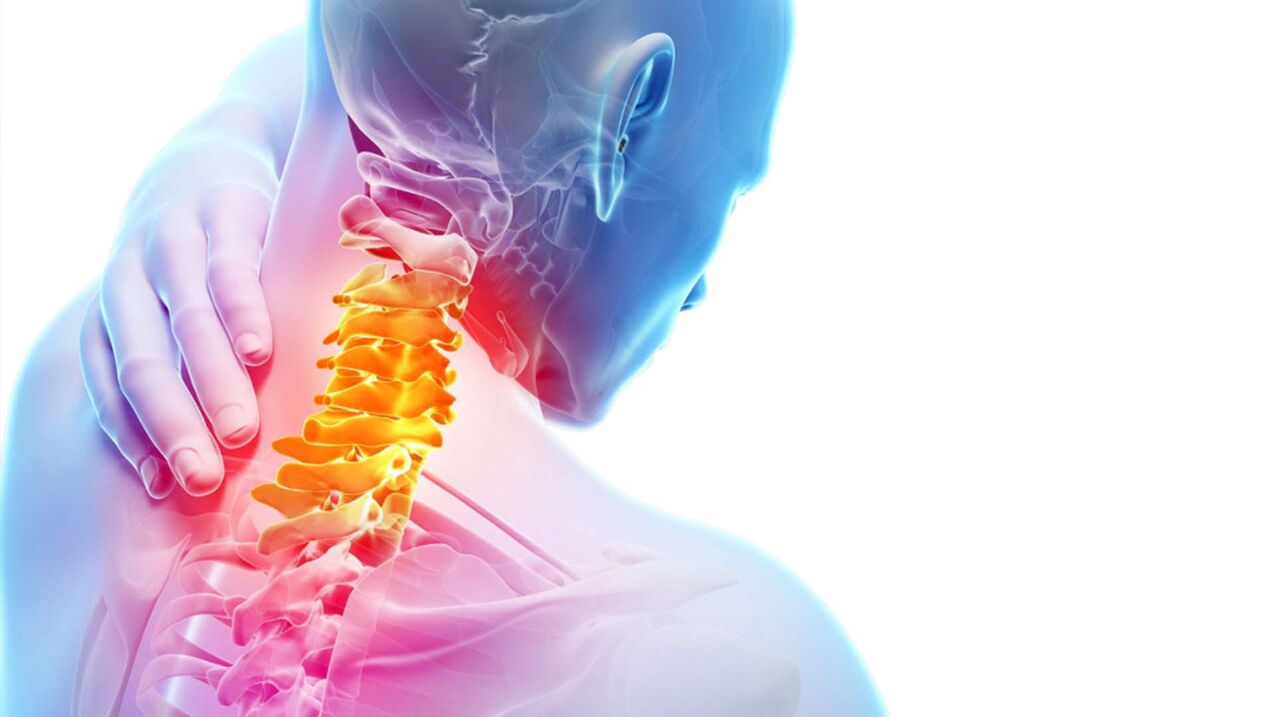osteochondrosis sa cervical spine