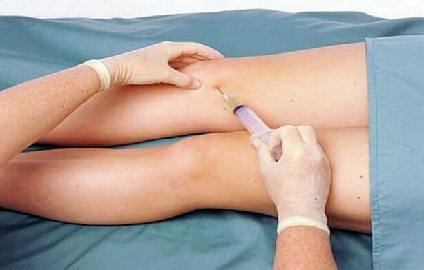 Ang degree sa arthrosis sa lutahan sa tuhod