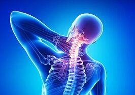 osteochondrosis - usa ka sakit sa spine