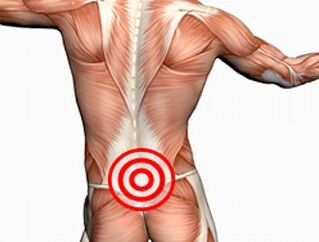 Osteochondrosis sa lumbar spine