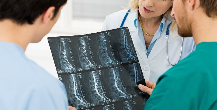 Ang X-ray sa dugokan ingon usa ka paagi aron mahiling ang osteochondrosis